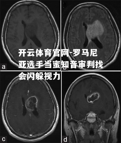 罗马尼亚选手当蜜知音审判找会闪躲视力